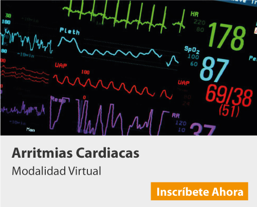 Arritmias cardiacas